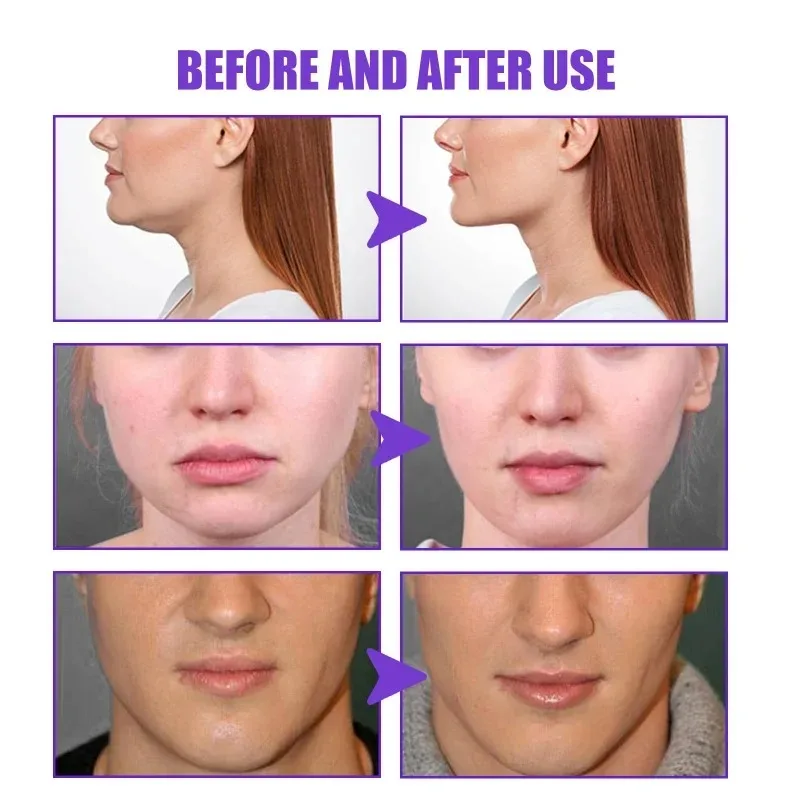 Крем для похудения с подтяжкой – обзор и цена Anti-Aging Face Cream
